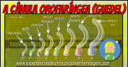 A C nula Orofar ngea Guedel Enfermagem Ilustrada