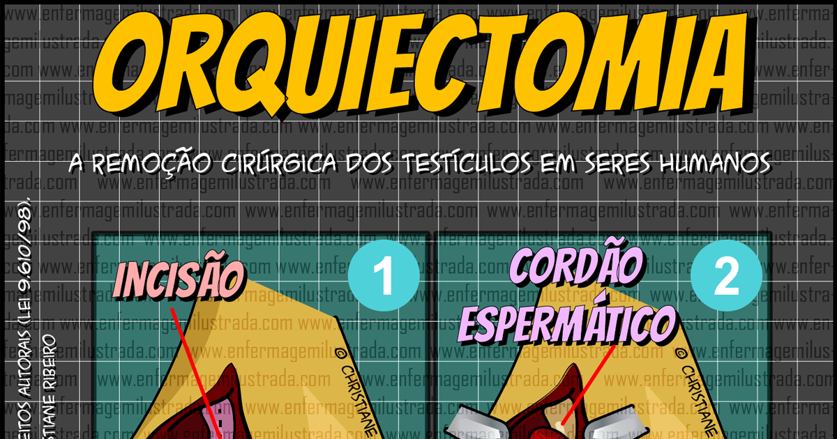 Orquiectomia - Enfermagem Ilustrada
